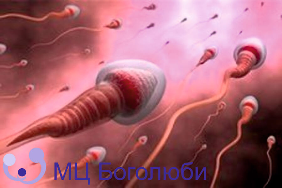 Порушення сперматогенезу, фото